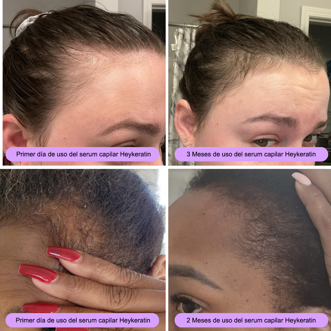 Serum capilar I Activá tus raíces