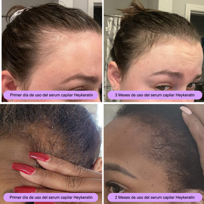 Serum capilar I Activá tus raíces